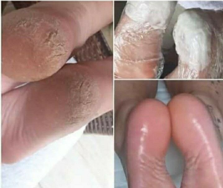 Trabalho de Manicure/Pedicure por Valeria Leite perales em Jardim Presidente Dutra, Guarulhos — foto 26 de 41