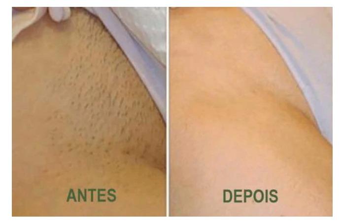 Trabalho de Manicure/Pedicure por Valeria Leite perales em Jardim Presidente Dutra, Guarulhos — foto 32 de 41