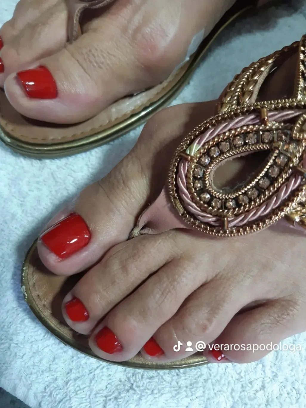 Trabalho de Podólogo(a) por Vera Rosa Podologa em Praia Grande — foto 14 de 17