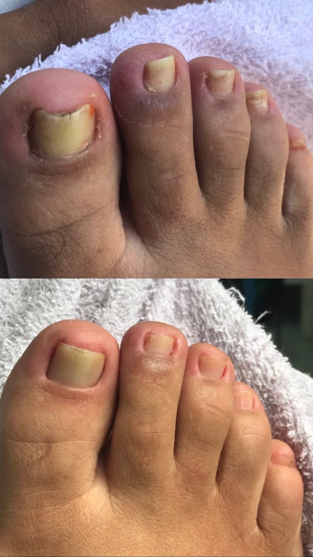 Trabalho de Manicure/Pedicure por Amanda Costa Chagas em Parque das Laranjeiras, Guarulhos — foto 5 de 6