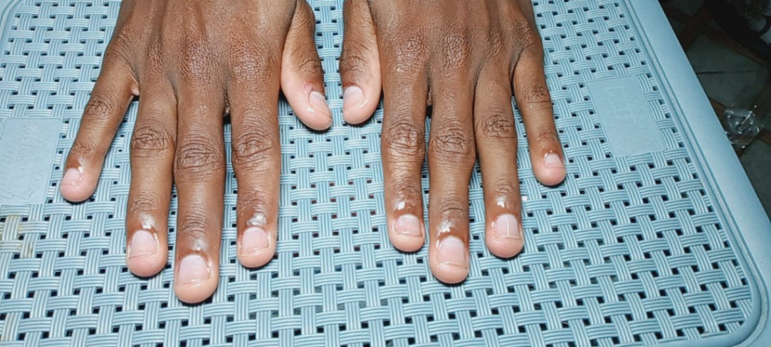 Trabalho de Manicure/Pedicure por Jamili Silva Ribeiro em Jardim São Paulo(Zona Leste), São Paulo — foto 8 de 16