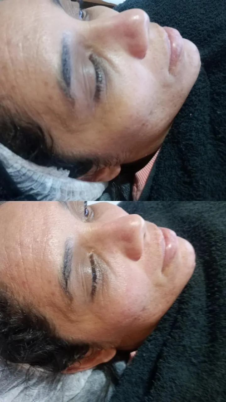 Trabalho de Esteticista por Edilamar Santana do Carmo em Vila UrsulinaUrsulina , Itaquaquecetuba — foto 5 de 26