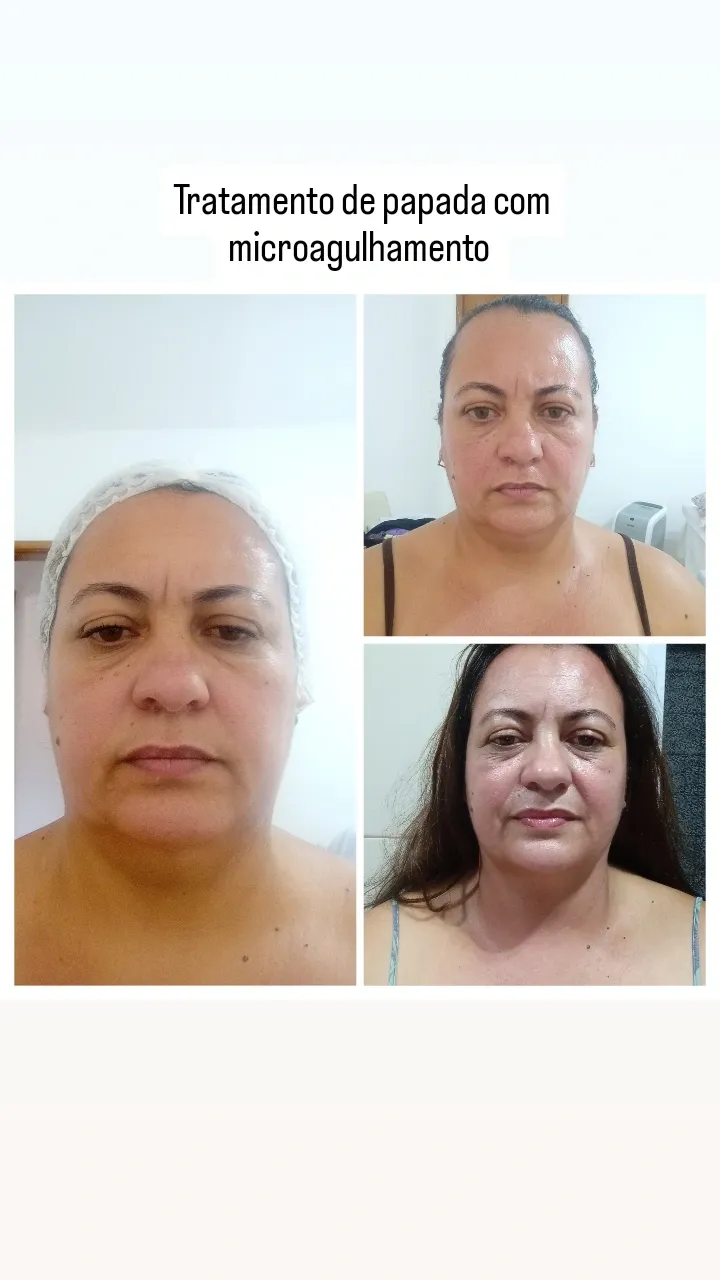 Trabalho de Esteticista por Edilamar Santana do Carmo em Vila UrsulinaUrsulina , Itaquaquecetuba — foto 10 de 26