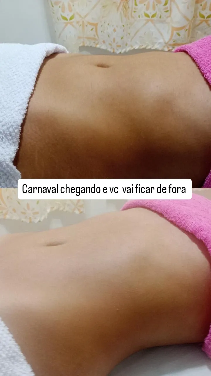 Trabalho de Esteticista por Edilamar Santana do Carmo em Vila UrsulinaUrsulina , Itaquaquecetuba — foto 11 de 26