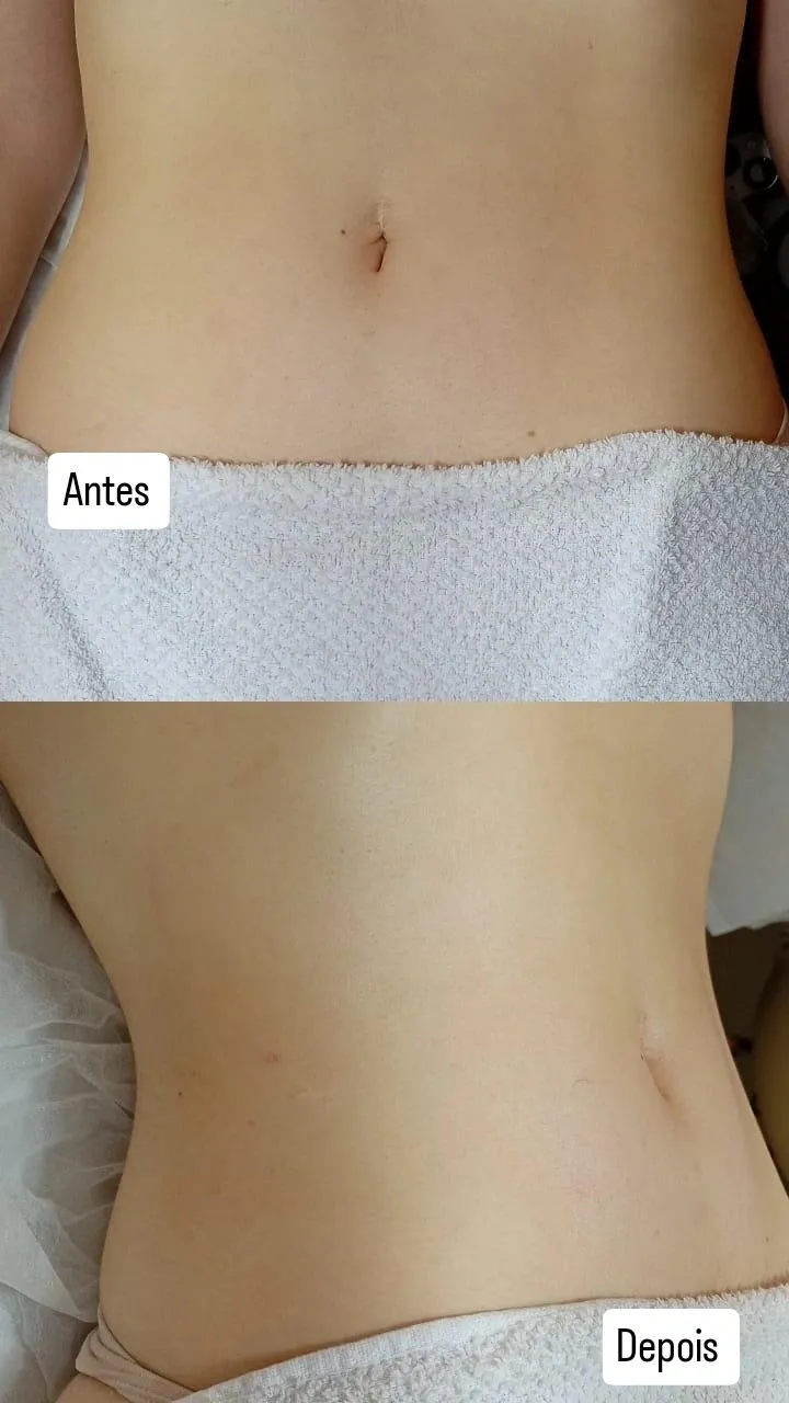 Trabalho de Esteticista por Edilamar Santana do Carmo em Vila UrsulinaUrsulina , Itaquaquecetuba — foto 12 de 26