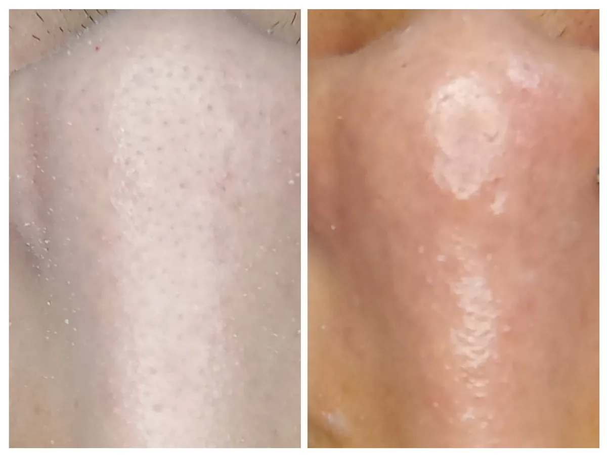 Trabalho de Esteticista por Edilamar Santana do Carmo em Vila UrsulinaUrsulina , Itaquaquecetuba — foto 22 de 26
