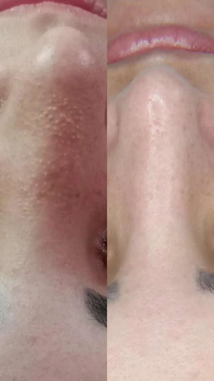 Trabalho de Esteticista por Edilamar Santana do Carmo em Vila UrsulinaUrsulina , Itaquaquecetuba — foto 25 de 26