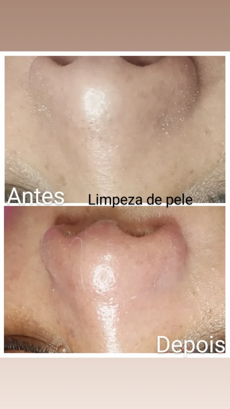 Trabalho de Esteticista por Edilamar Santana do Carmo em Vila UrsulinaUrsulina , Itaquaquecetuba — foto 26 de 26