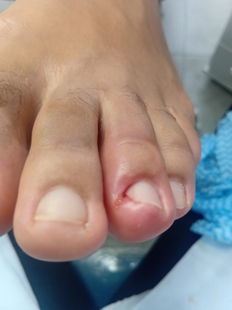 Trabalho de Manicure/Pedicure por Deise Assis em Vila Brasilina, São Paulo — foto 10 de 30