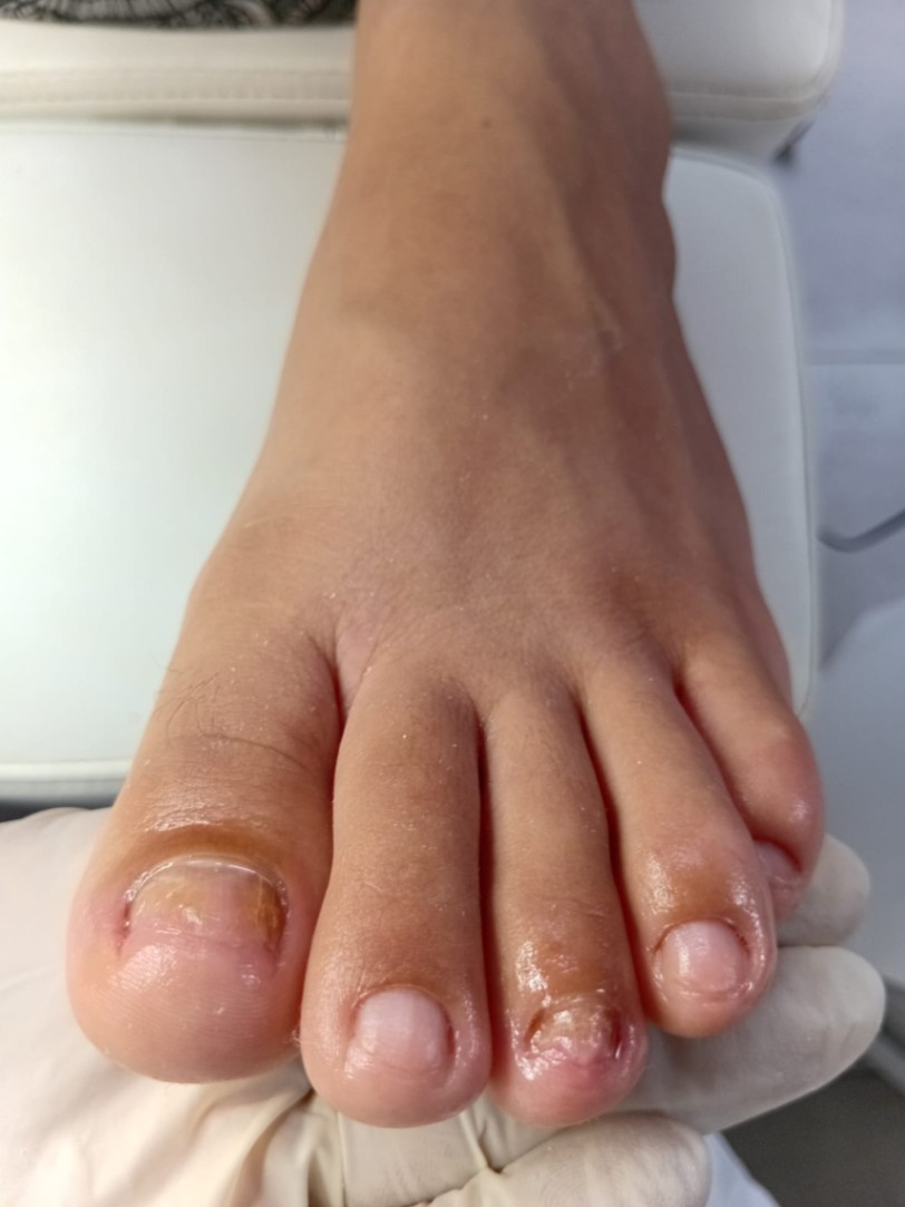 Trabalho de Manicure/Pedicure por Deise Assis em Vila Brasilina, São Paulo — foto 13 de 30