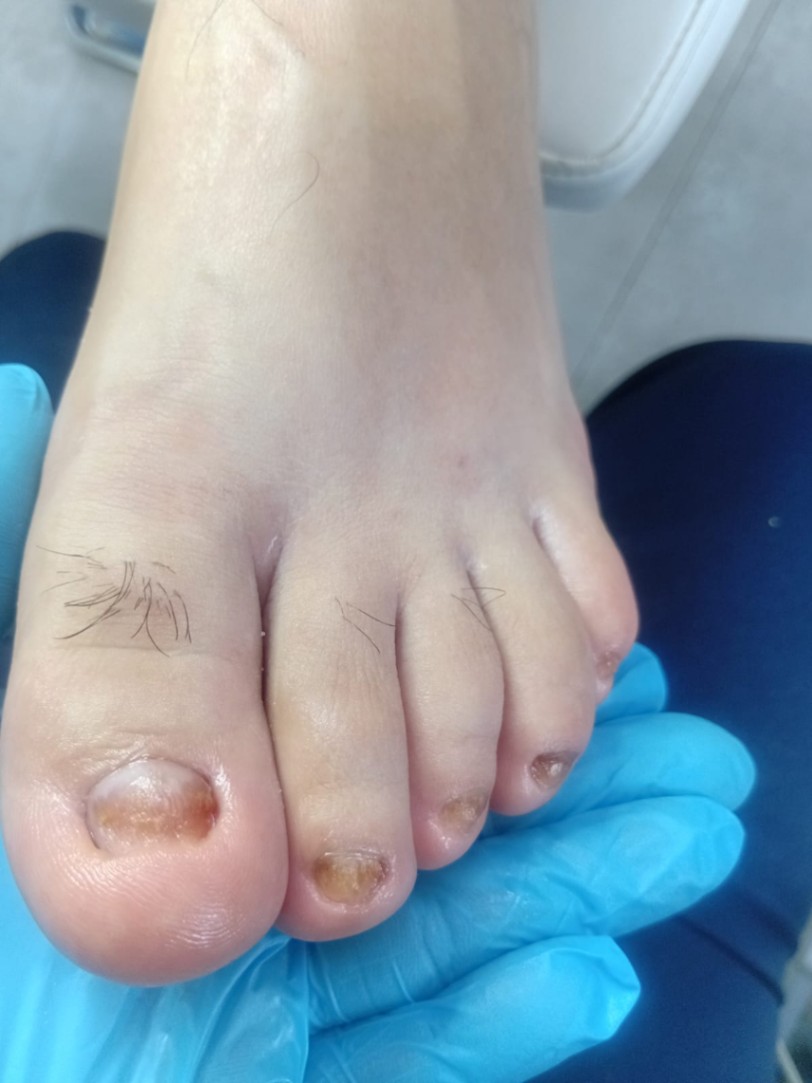 Trabalho de Manicure/Pedicure por Deise Assis em Vila Brasilina, São Paulo — foto 21 de 30