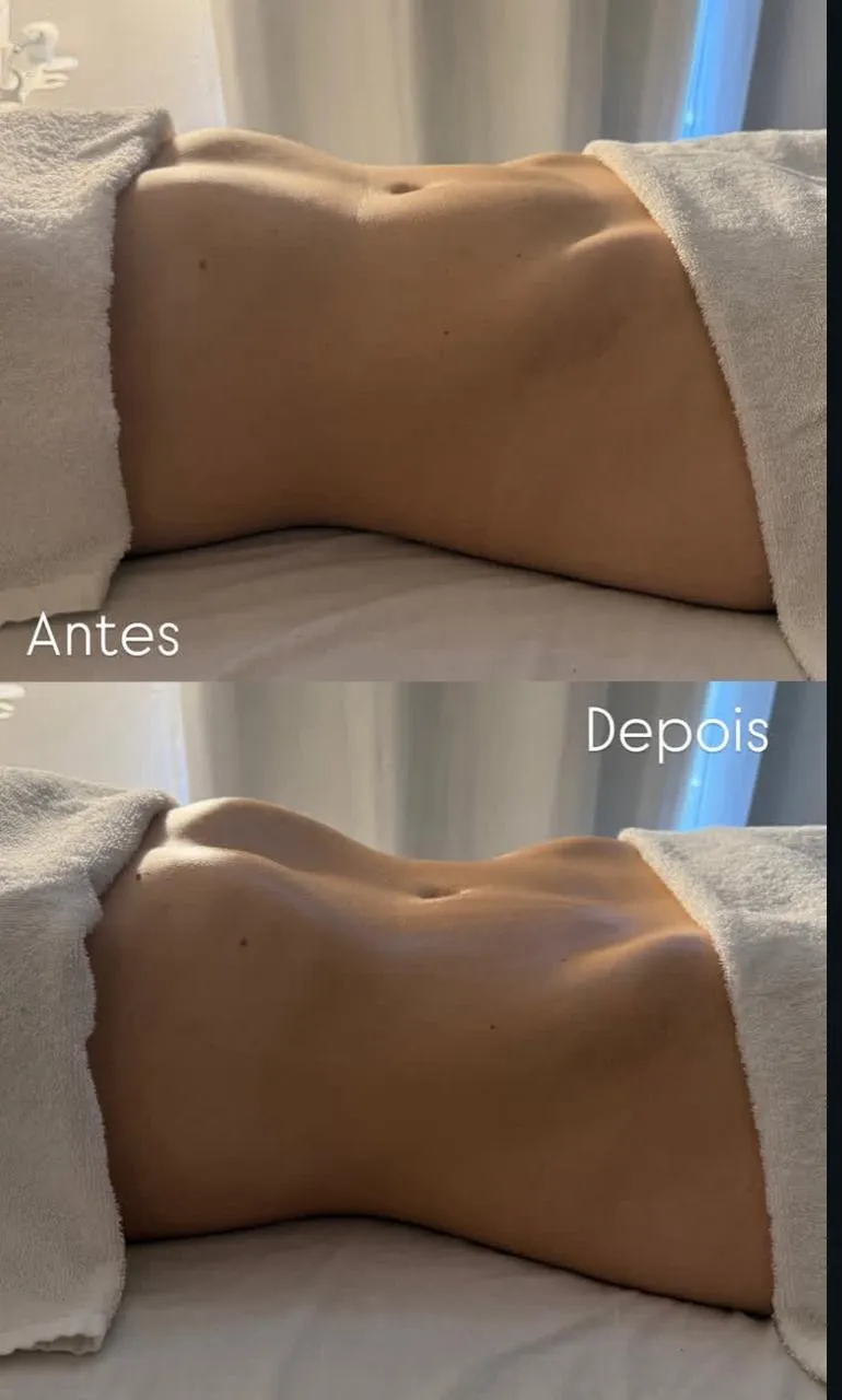 Trabalho de Massoterapeuta por Cassiane de Jesus Sousa em São Paulo — foto 5 de 7