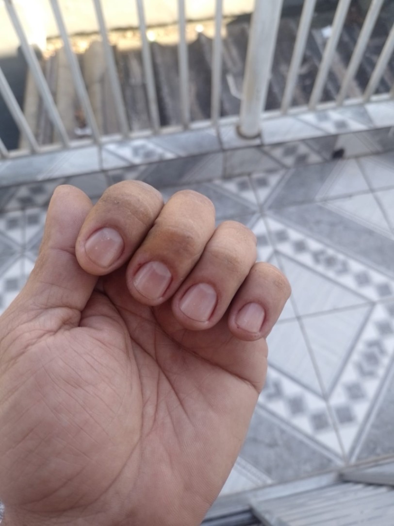 Trabalho de Manicure/Pedicure por Thaina Medeiros em Jardim Planalto, São Paulo — foto 9 de 18
