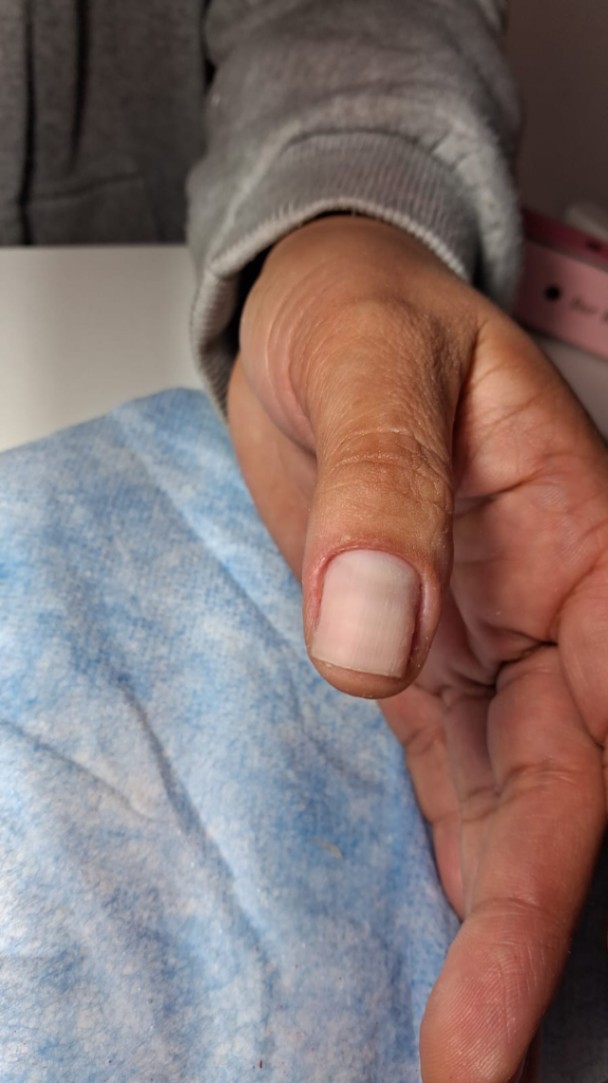 Trabalho de Manicure/Pedicure por Renata freire da silva em Jardim Adriana, Guarulhos — foto 7 de 8