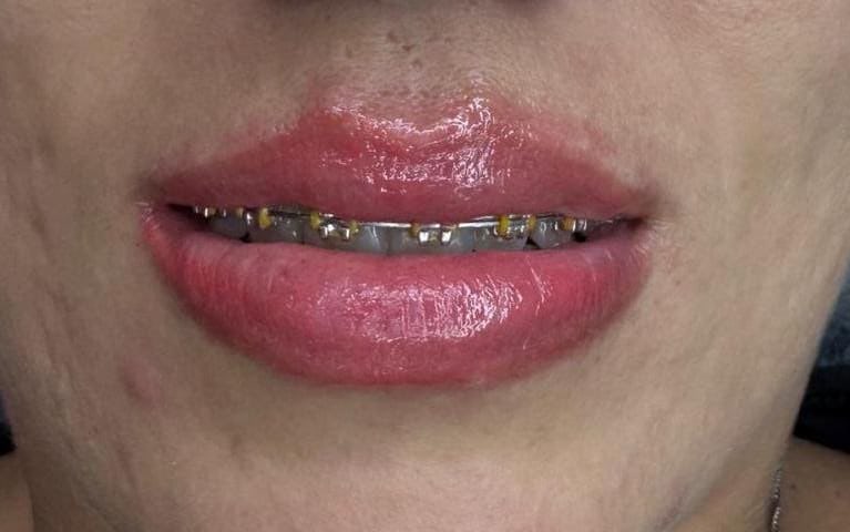 Trabalho de Manicure/Pedicure por Joanice Cardoso em Vila Leonor, São Paulo — foto 12 de 19