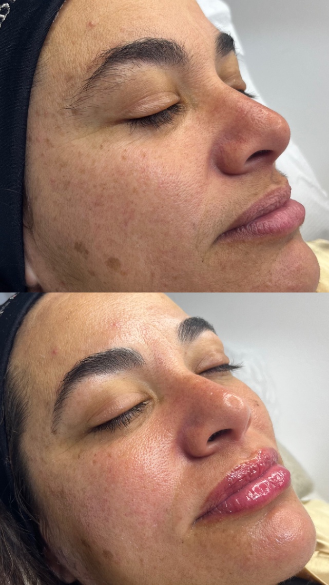 Trabalho de Esteticista por Fabiana Guimaraes em Jardim Nazareth, São Paulo — foto 1 de 17