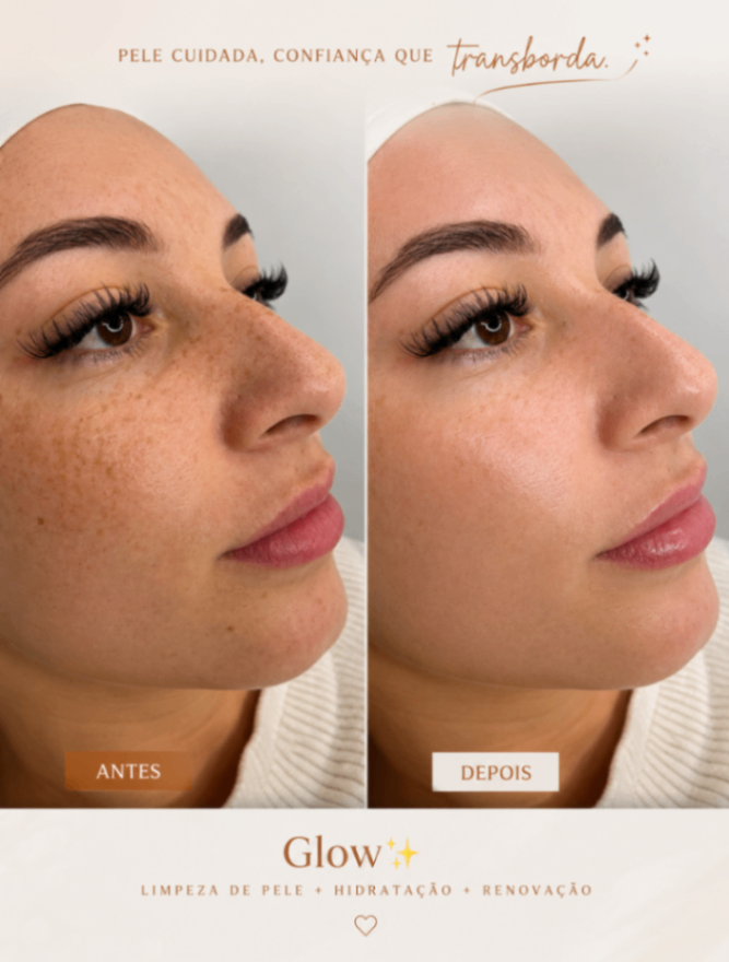 Trabalho de Esteticista por Fabiana Guimaraes em Jardim Nazareth, São Paulo — foto 6 de 17
