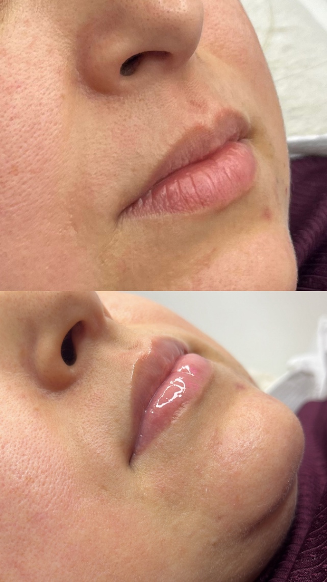 Trabalho de Esteticista por Fabiana Guimaraes em Jardim Nazareth, São Paulo — foto 7 de 17
