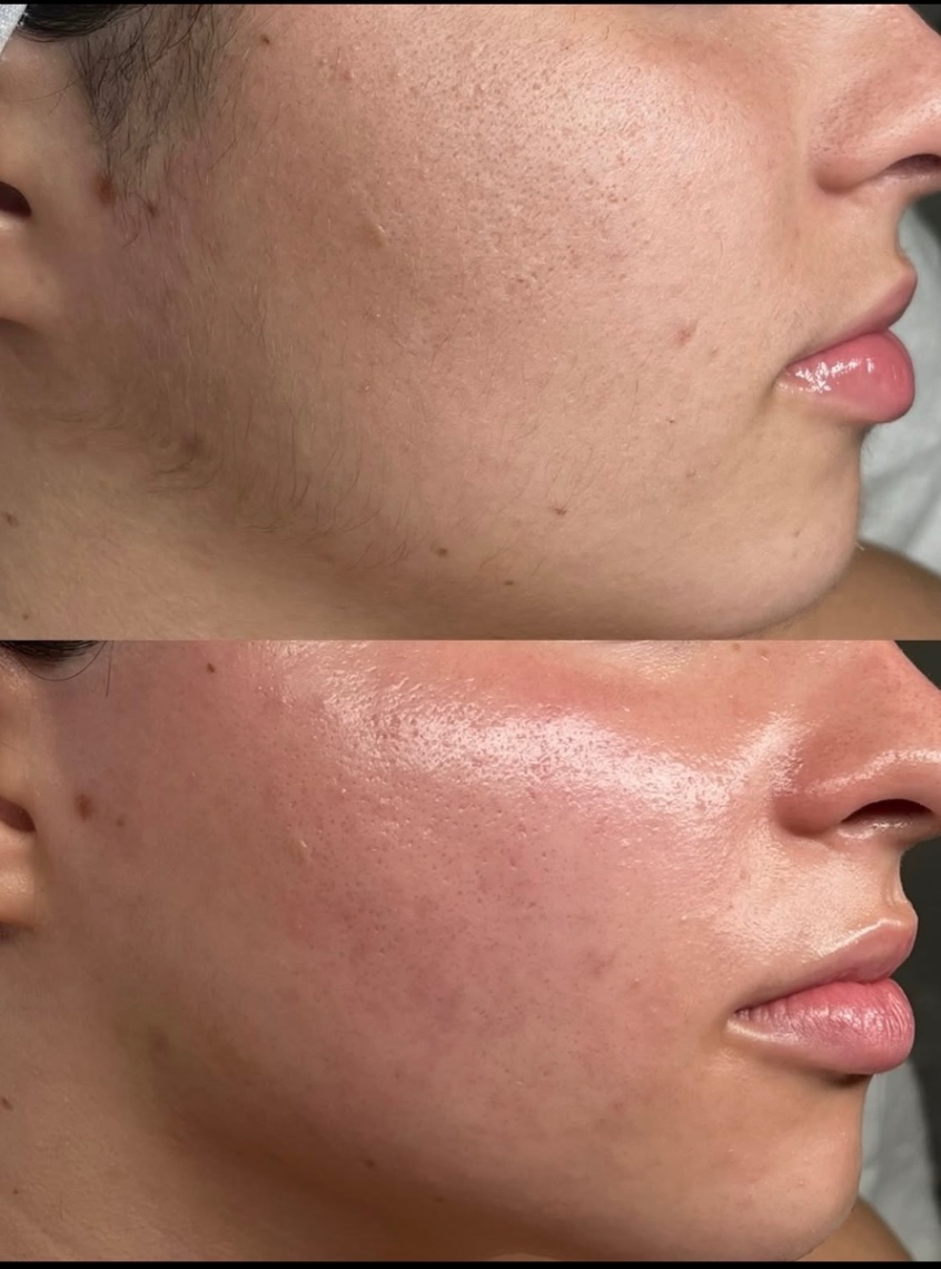 Trabalho de Esteticista por Fabiana Guimaraes em Jardim Nazareth, São Paulo — foto 8 de 17