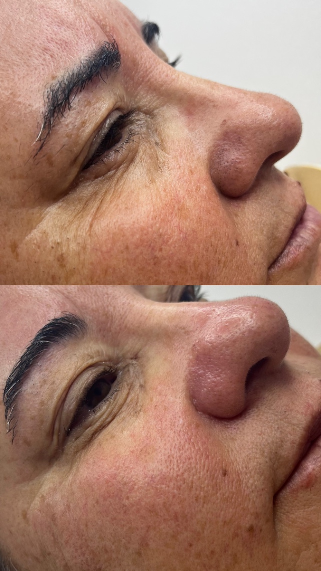 Trabalho de Esteticista por Fabiana Guimaraes em Jardim Nazareth, São Paulo — foto 9 de 17