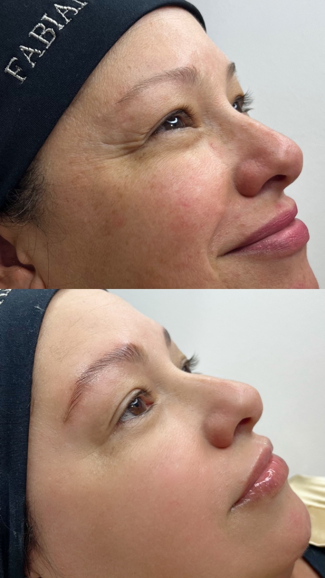 Trabalho de Esteticista por Fabiana Guimaraes em Jardim Nazareth, São Paulo — foto 16 de 17