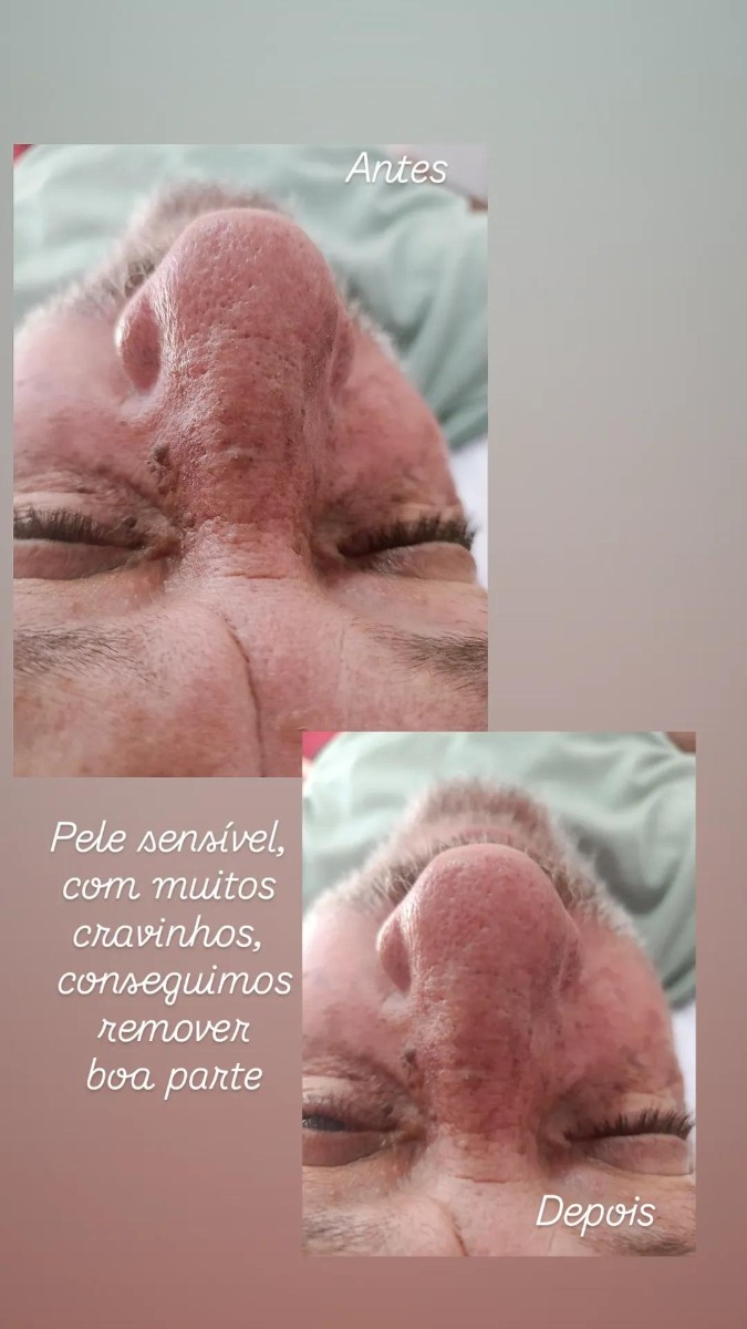Trabalho de Manicure/Pedicure por Fabrícia Santana em Jardim Morada do Sol, Indaiatuba — foto 2 de 11