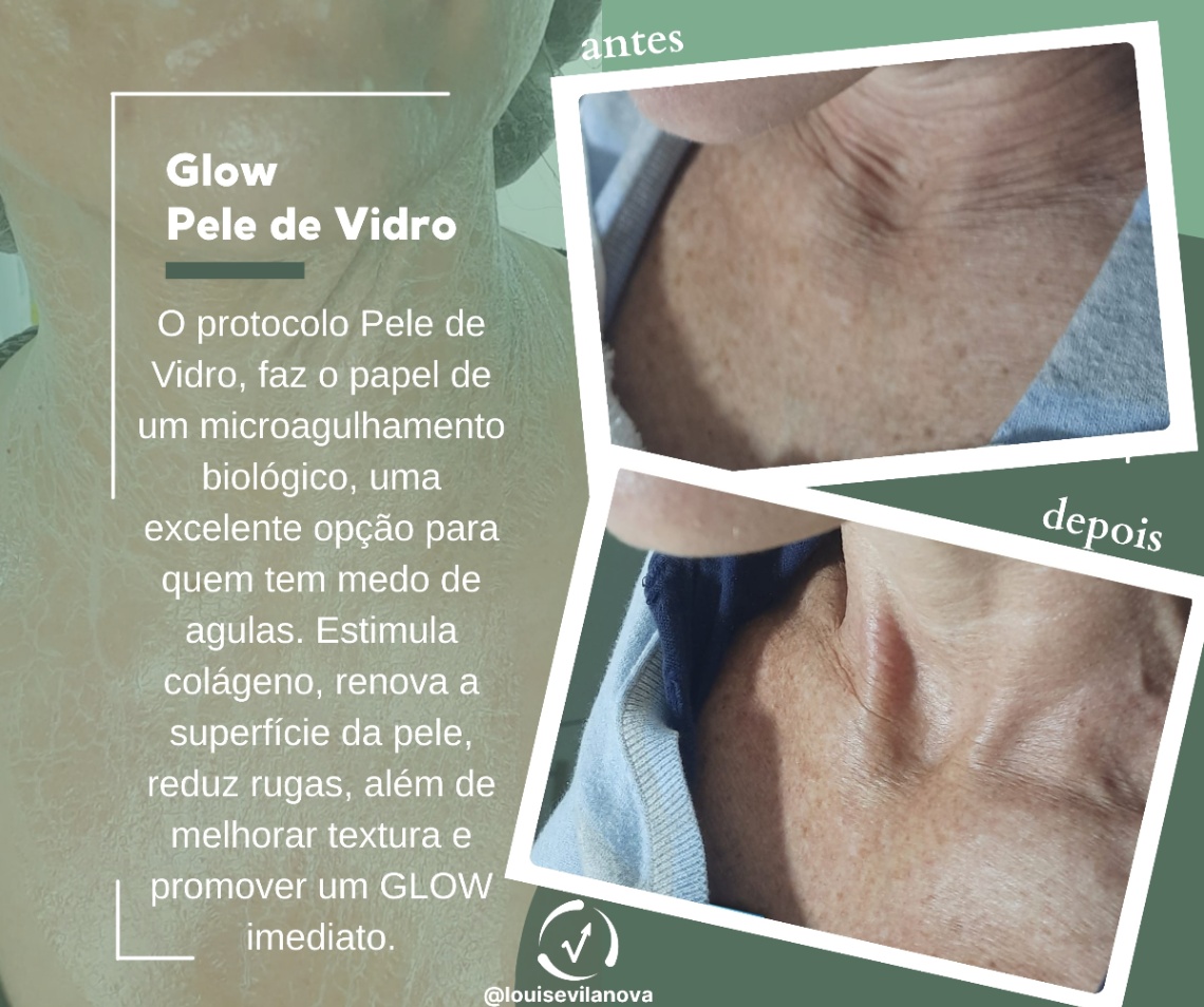Trabalho de Esteticista por Louise Vilanova em Indianópolis, São Paulo — foto 7 de 15