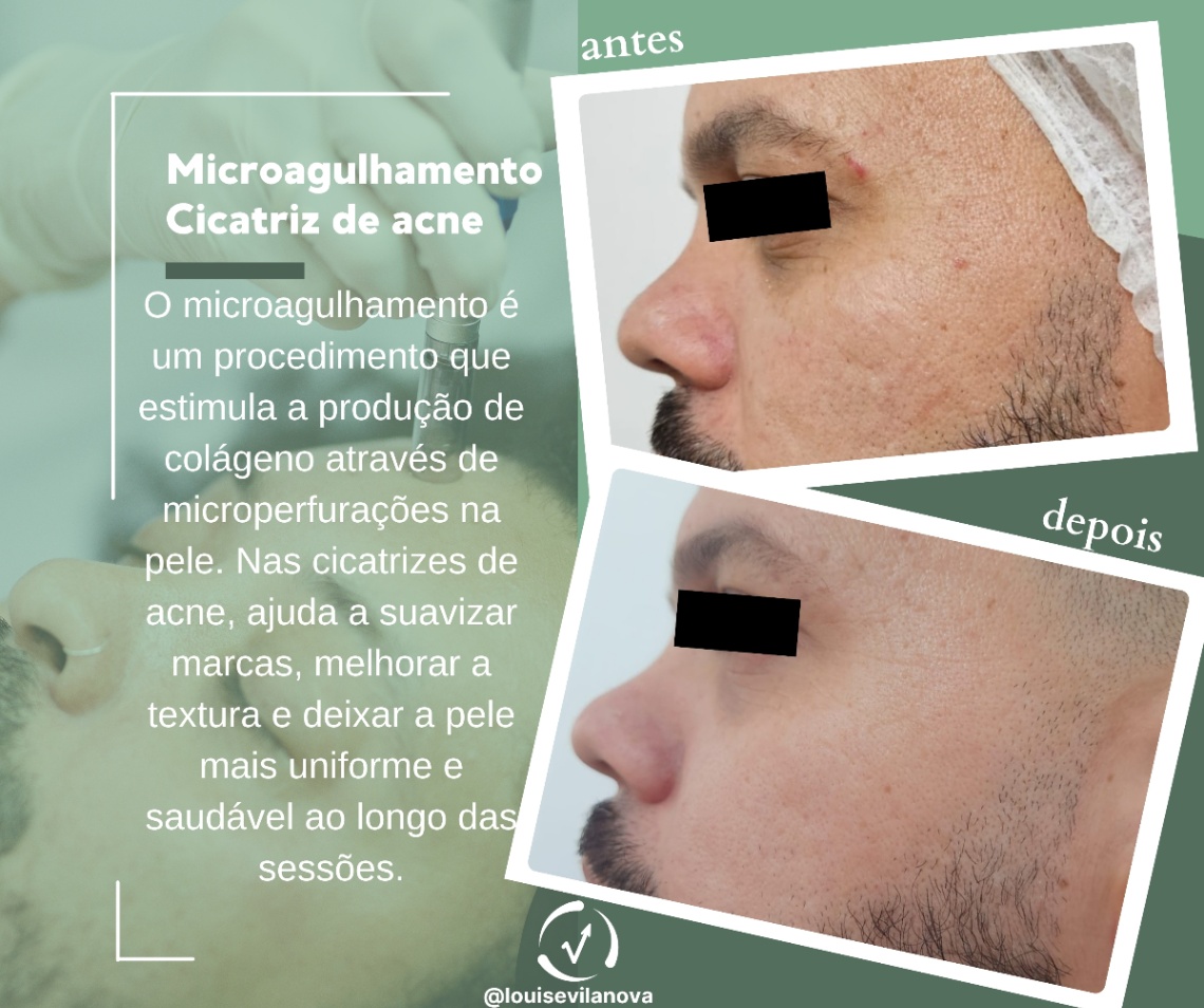 Trabalho de Esteticista por Louise Vilanova em Indianópolis, São Paulo — foto 8 de 15