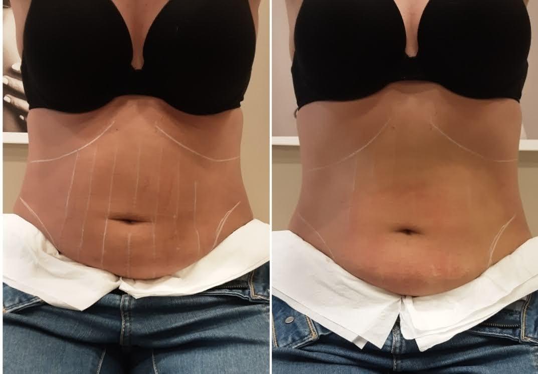 Trabalho de Esteticista por Louise Vilanova em Indianópolis, São Paulo — foto 11 de 15