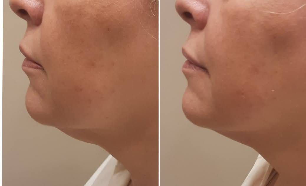 Trabalho de Esteticista por Louise Vilanova em Indianópolis, São Paulo — foto 12 de 15