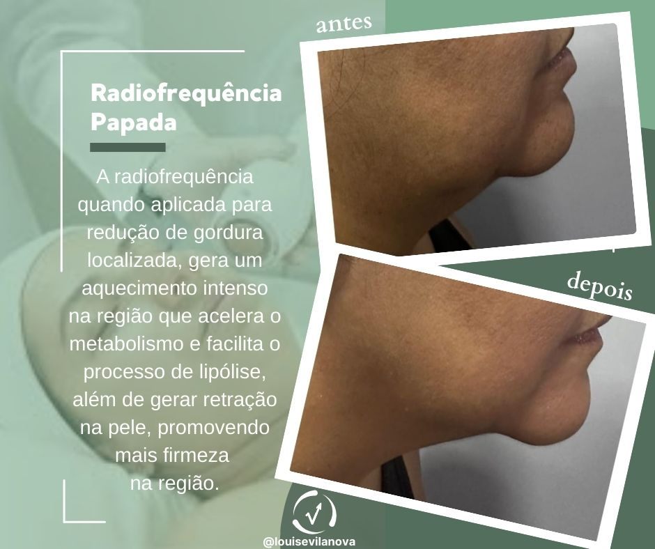 Trabalho de Esteticista por Louise Vilanova em Indianópolis, São Paulo — foto 13 de 15