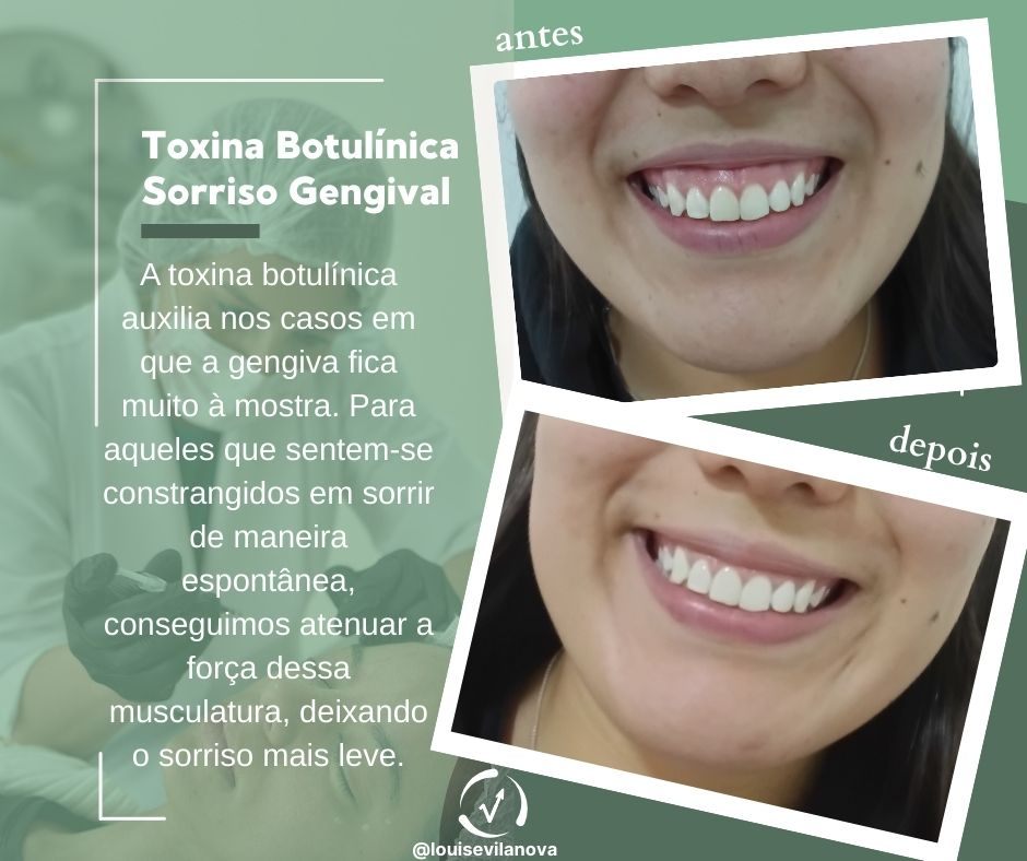 Trabalho de Esteticista por Louise Vilanova em Indianópolis, São Paulo — foto 15 de 15