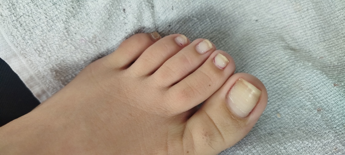 Trabalho de Manicure/Pedicure por Lígia Cristina Guinaço de Araujo em Jardim Paulista, Barueri — foto 8 de 14
