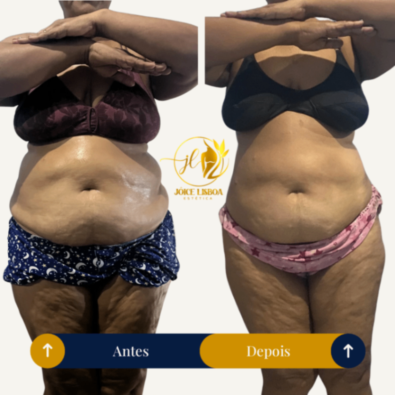 Trabalho de Esteticista por Jôice Mara Lisboa de Oliveira em Vila Mathias, Santos — foto 2 de 11