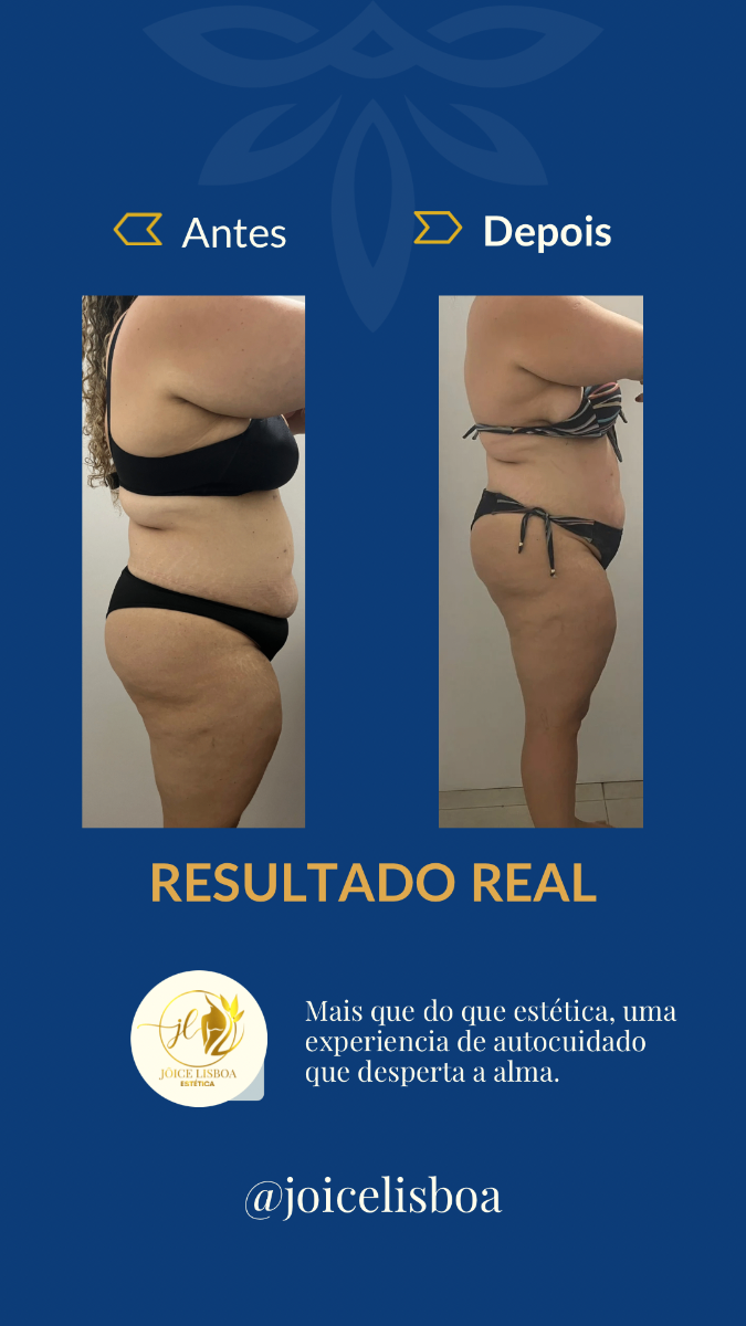 Trabalho de Esteticista por Jôice Mara Lisboa de Oliveira em Vila Mathias, Santos — foto 6 de 11