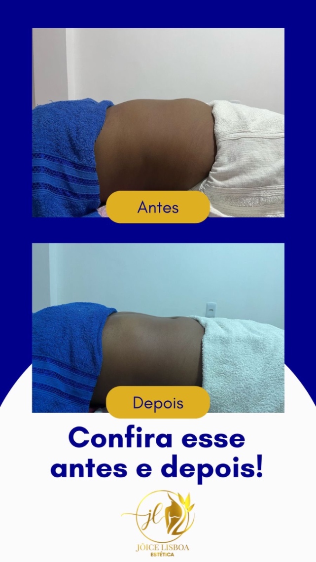 Trabalho de Esteticista por Jôice Mara Lisboa de Oliveira em Vila Mathias, Santos — foto 8 de 11