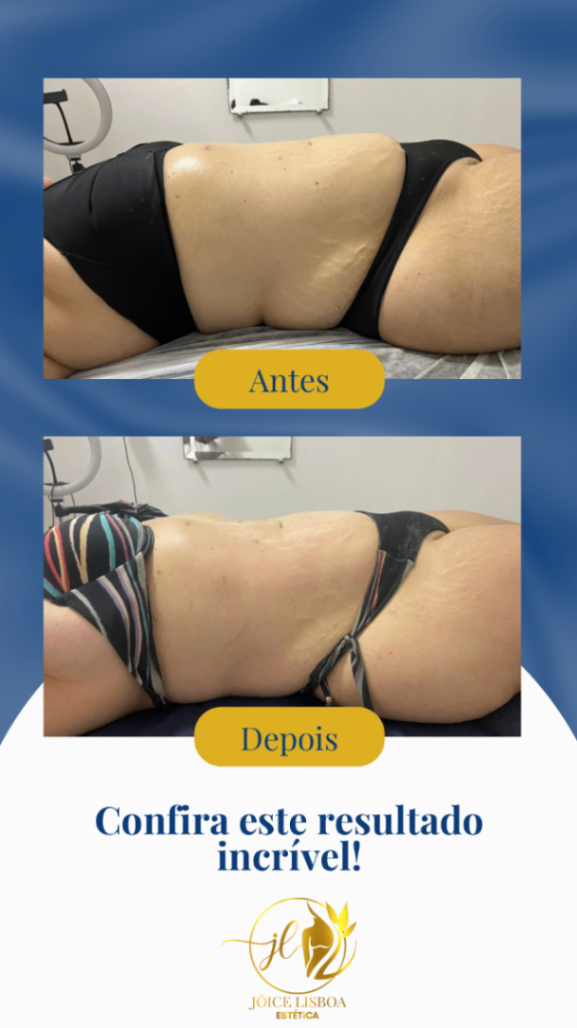 Trabalho de Esteticista por Jôice Mara Lisboa de Oliveira em Vila Mathias, Santos — foto 9 de 11