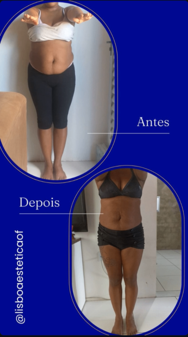Trabalho de Esteticista por Jôice Mara Lisboa de Oliveira em Vila Mathias, Santos — foto 10 de 11