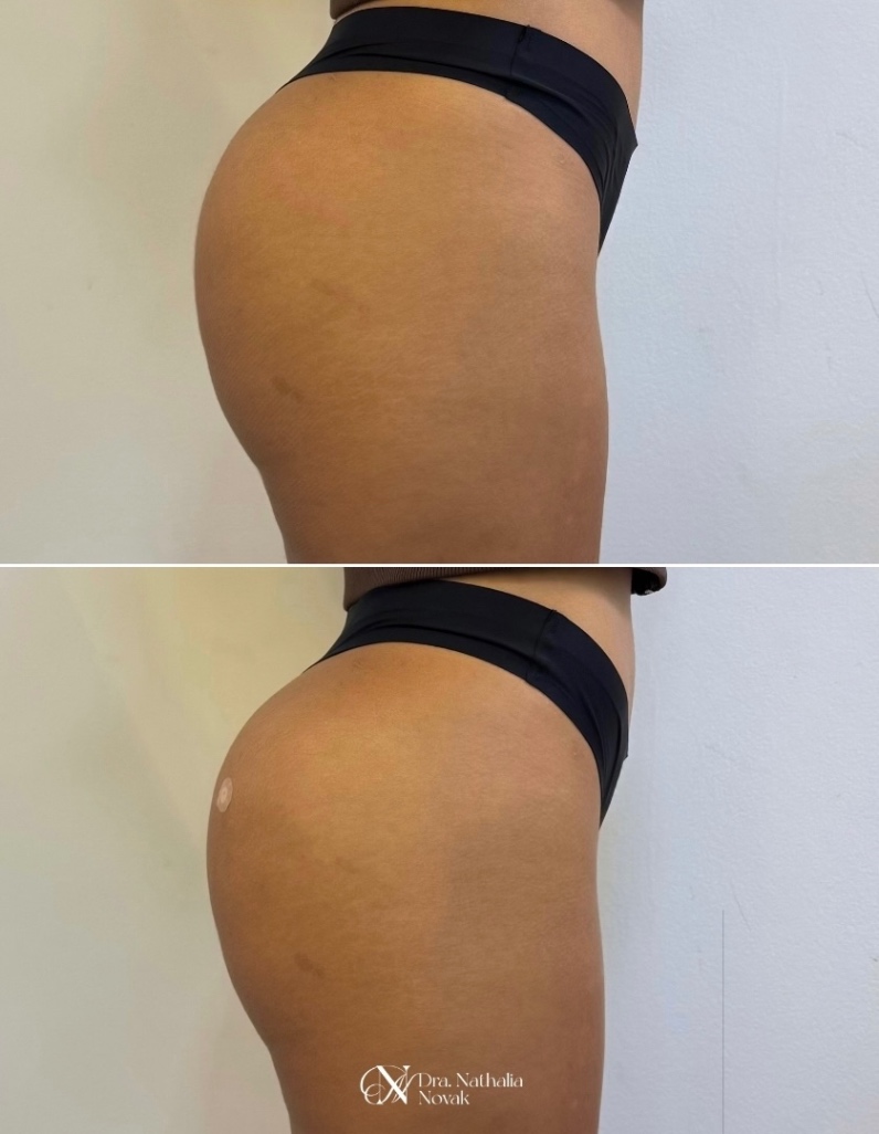 Trabalho de Biomédico(a) por nathalia novak em Vila Carrão, São Paulo — foto 15 de 22