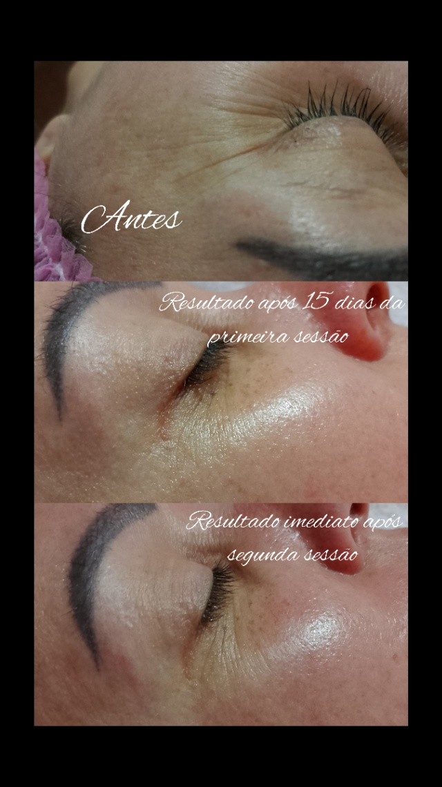 Trabalho de Esteticista por Ana Julia Alves em Rochdale, Osasco — foto 1 de 2