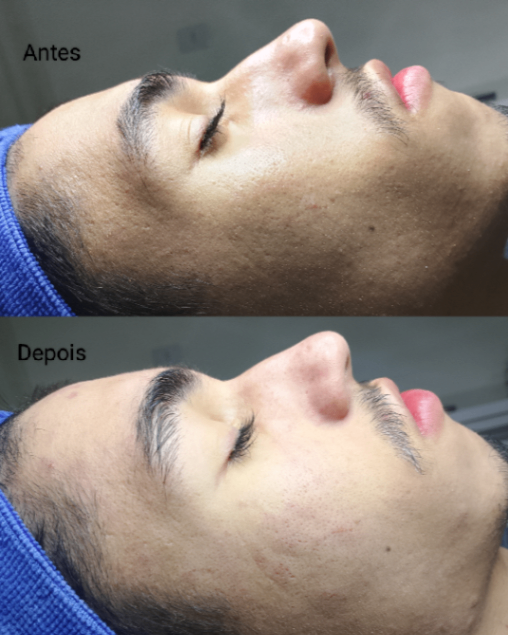 Trabalho de Esteticista por Ana Julia Alves em Rochdale, Osasco — foto 2 de 2