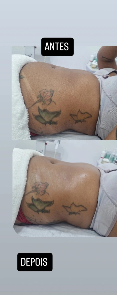 Trabalho de Esteticista por Silvania Henrique lima em Rochdale, Osasco — foto 1 de 3