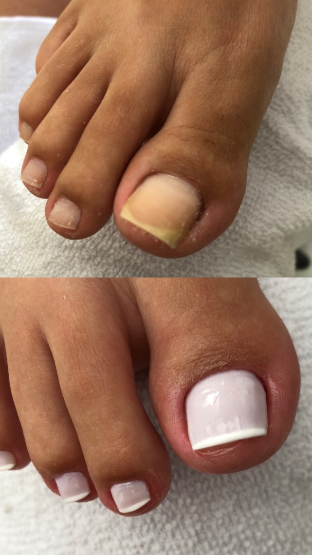Trabalho de Manicure/Pedicure por Isabela Messias em Morrinhos, Guarujá — foto 7 de 17