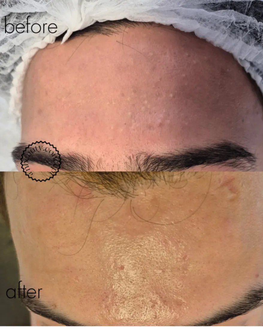Trabalho de Esteticista por Natasha Santos em Nove de Julho, Mogi das Cruzes — foto 2 de 7