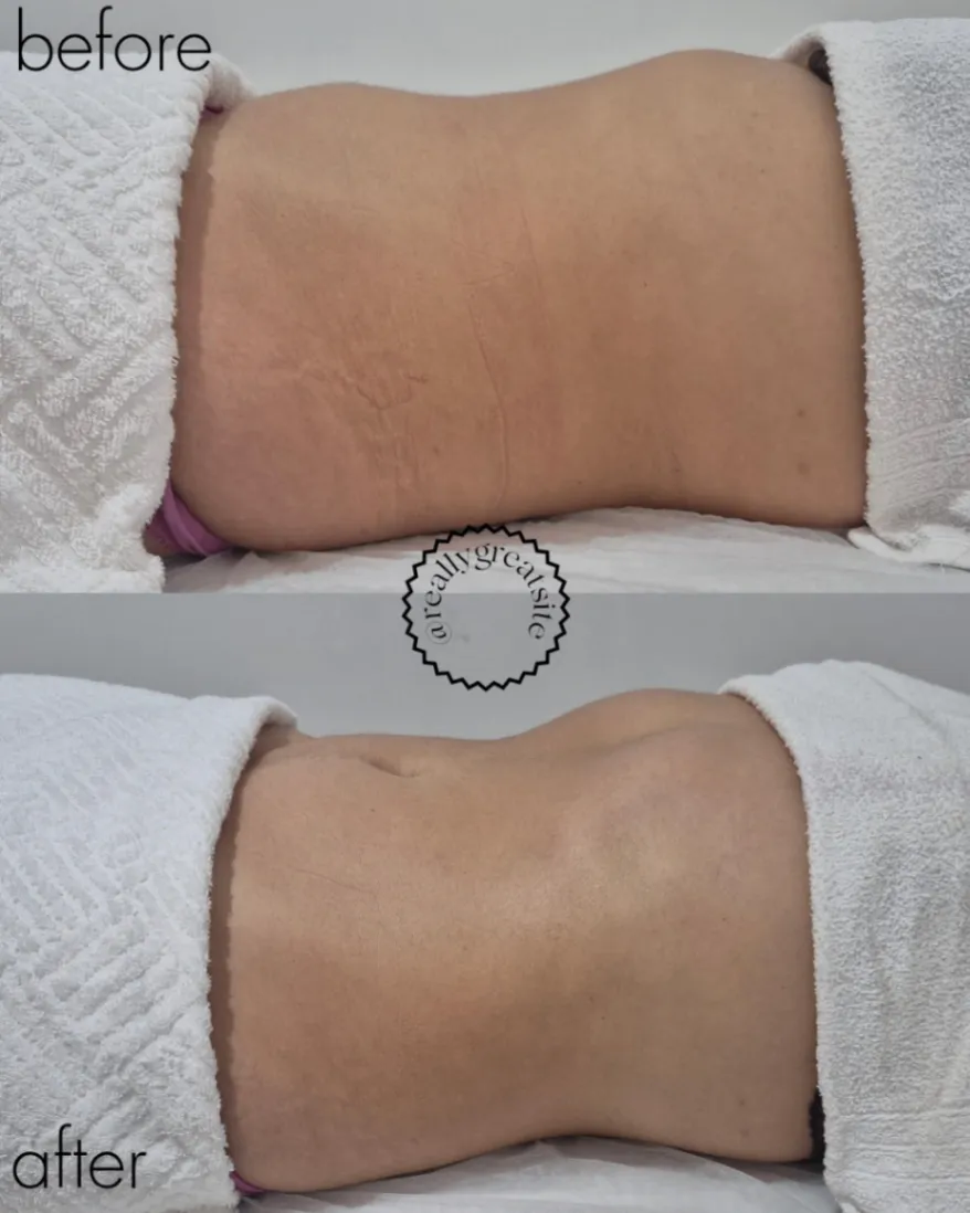 Trabalho de Esteticista por Natasha Santos em Nove de Julho, Mogi das Cruzes — foto 3 de 7