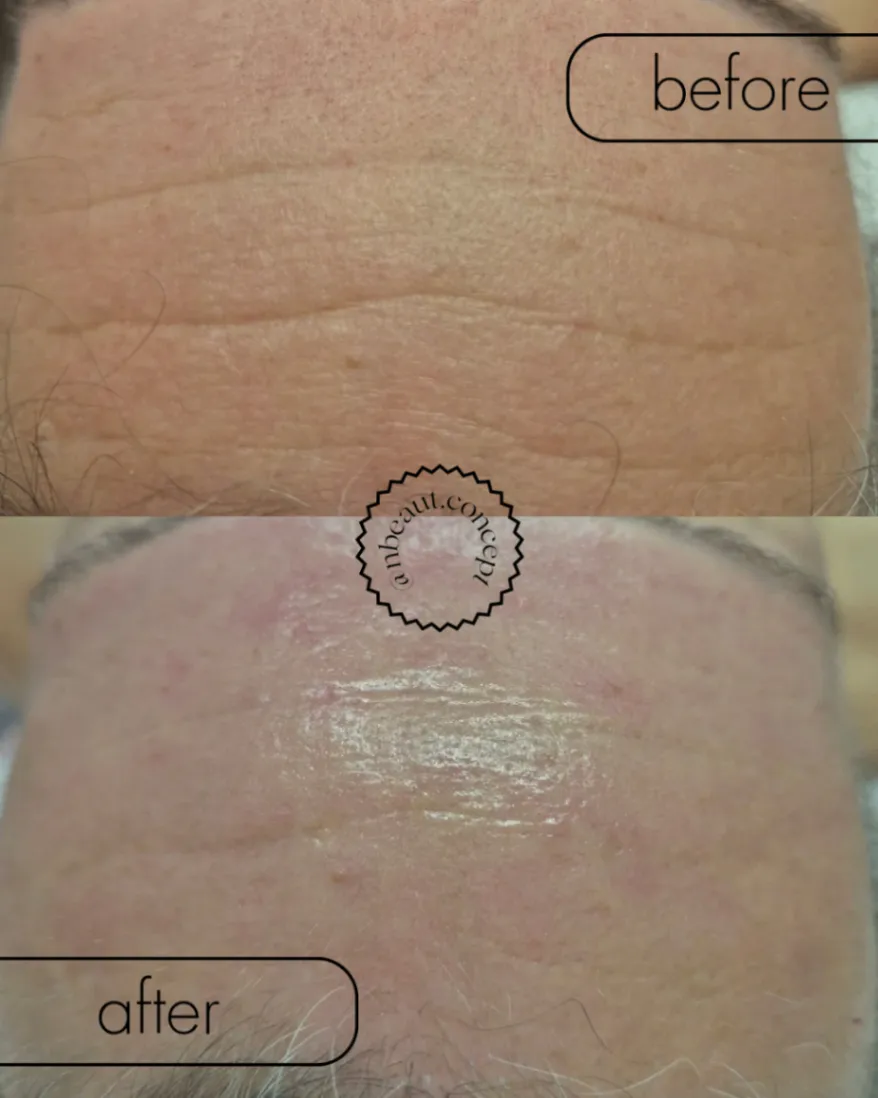 Trabalho de Esteticista por Natasha Santos em Nove de Julho, Mogi das Cruzes — foto 6 de 7
