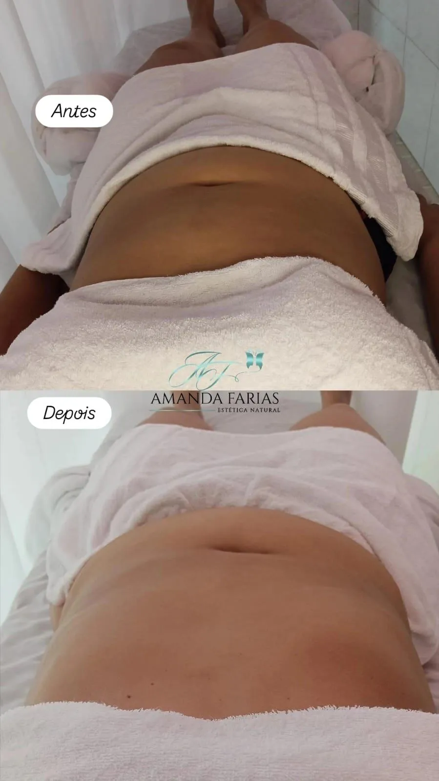 Trabalho de Massoterapeuta por Amanda Farias dos Santos em Parque Residencial Cocaia, São Paulo — foto 1 de 9