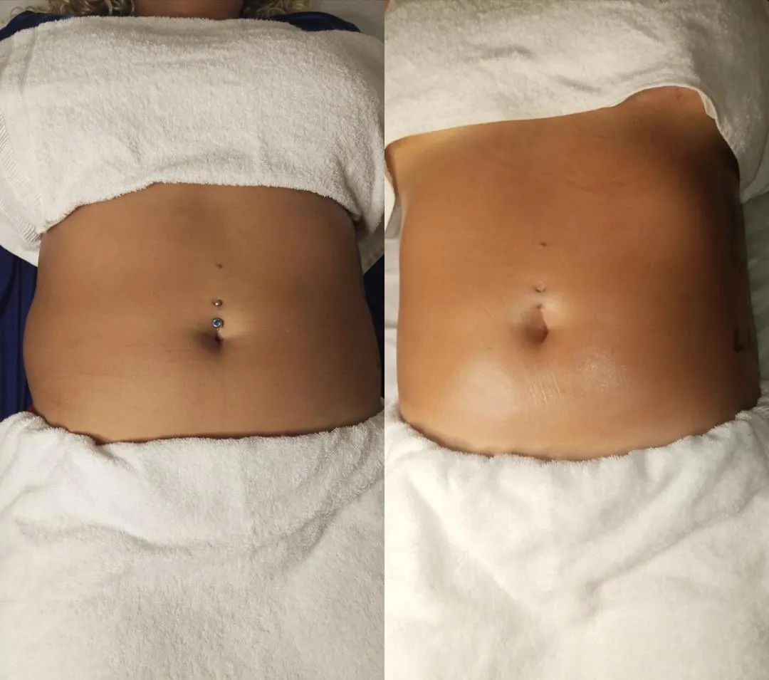 Trabalho de Massoterapeuta por Amanda Farias dos Santos em Parque Residencial Cocaia, São Paulo — foto 6 de 9