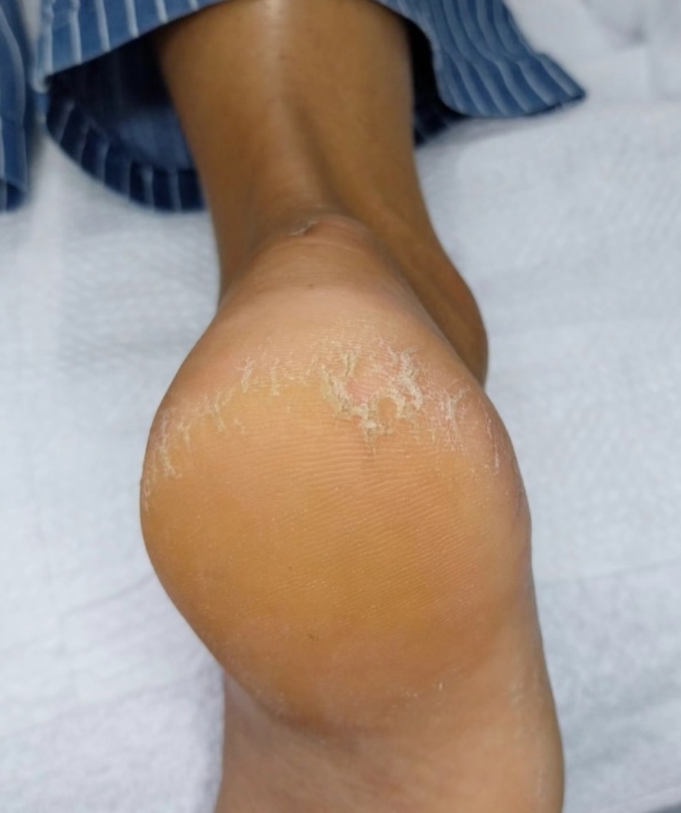 Trabalho de Manicure/Pedicure por Kaline Silva em Chácara Gaivotas, São Paulo — foto 2 de 8