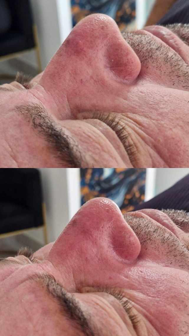 Trabalho de Esteticista por valeria braga Va em Vila Hermínia, São Paulo — foto 3 de 8